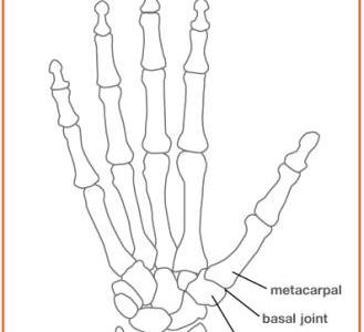 Trapeziectomy with Suspensionplasty