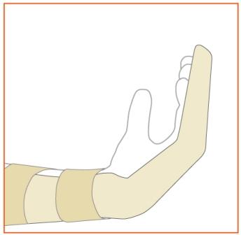 Image showing bandaging after surgery