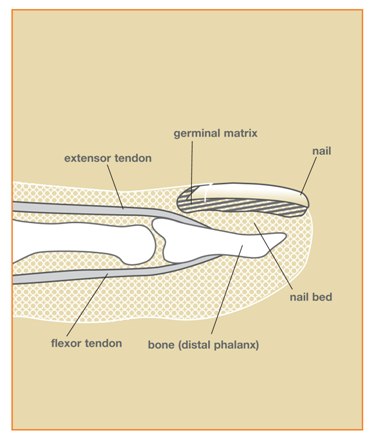 Approach to Nail Trauma – AOMC FOAMed