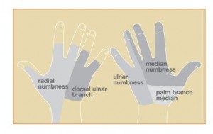 Image showing sensory distribution of nerves