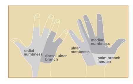 I get proximally 20% numbness in hands, both in thumb, index, middle fingers,  when I lift my shoulders symptoms go away, why is that? - Quora