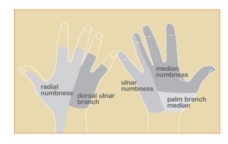 numbness of fingers right hand
