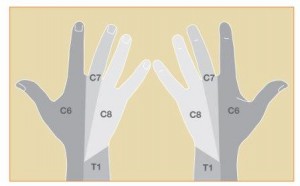 Image showing cervical root distribution