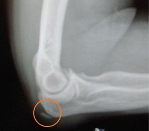 X-ray image of elbow