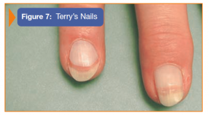 Image showing Terry's Nails