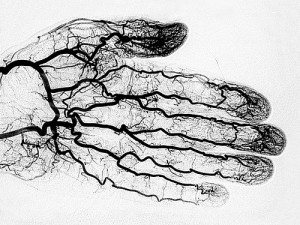 Image showing blood vessels