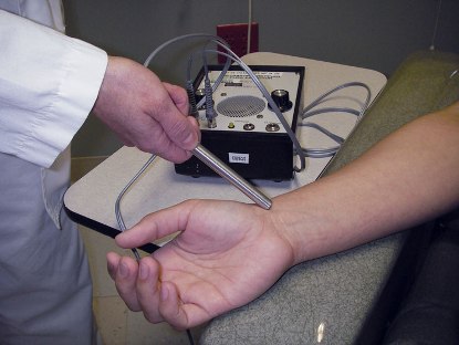 Doppler ultrasound